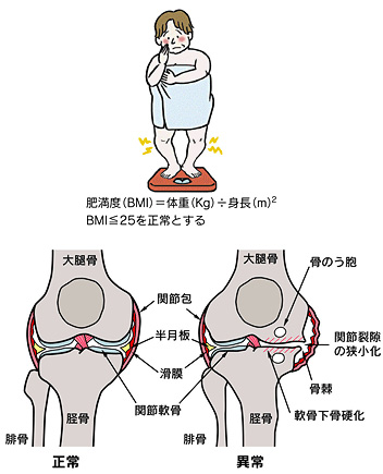 膝の症状・疾患
