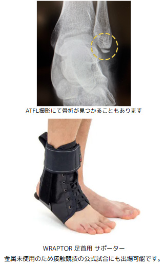 足関節捻挫・靱帯損傷